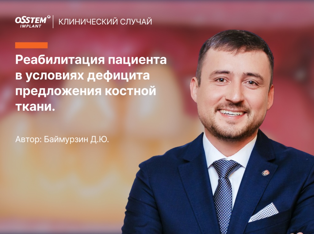 1 Баймурзин кейс.jpg