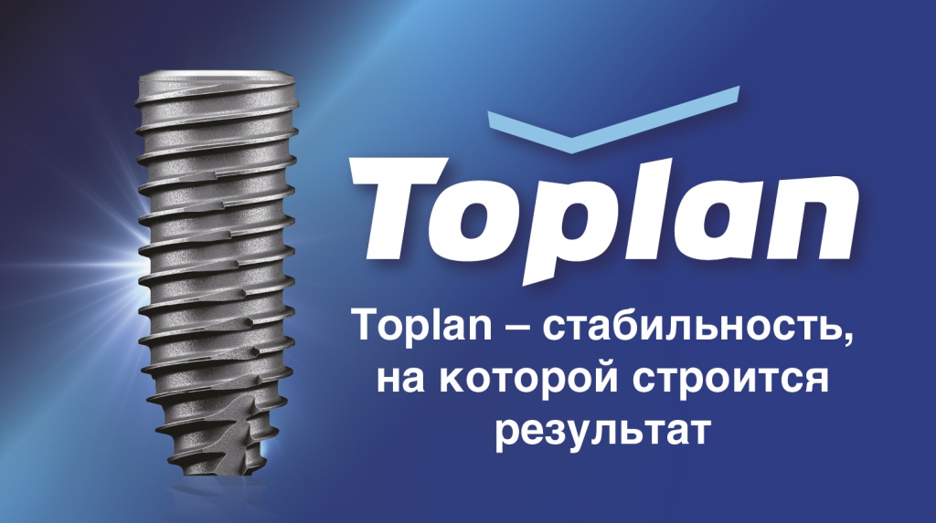 Toplan для сайта Osstem-04.jpg