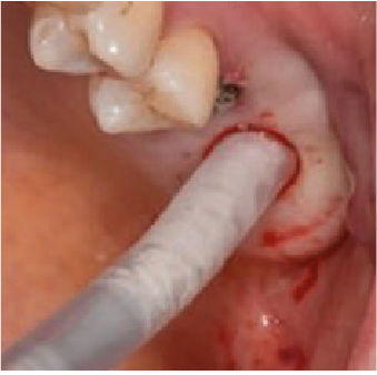 Ресурс 2@3x.png