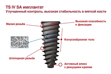 Имплантаты TS IV SA