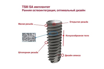 Имплантаты TS III SA