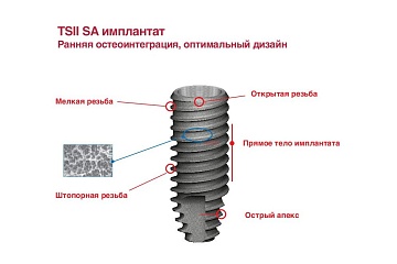 Имплантаты TS II SA