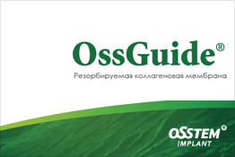 OssGuide