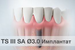 TSIII SA Ø3.0 Имплантат