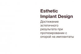 Esthetic Implant Design - Протезирование с опорой на имплантаты Осстем