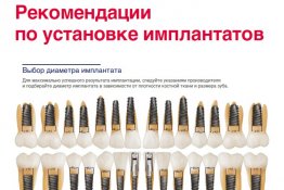 Рекомендации по установке